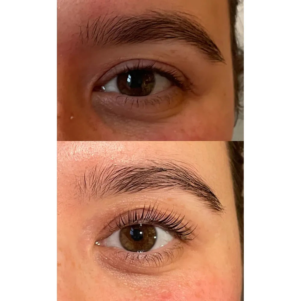 BYG™ | LASH LIFT KIT